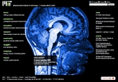 A more detailed MRI